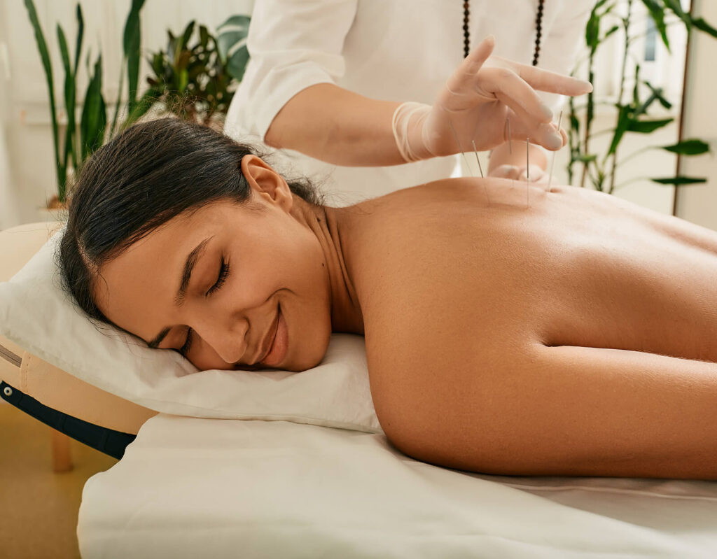 Image of a woman being treated by an acupuncturist in the Chicago area. With holistic acupuncture you don't have to live in pain. Get in contact with us for you first appointment for acupuncture in Orland Park, IL 60467. Book now!