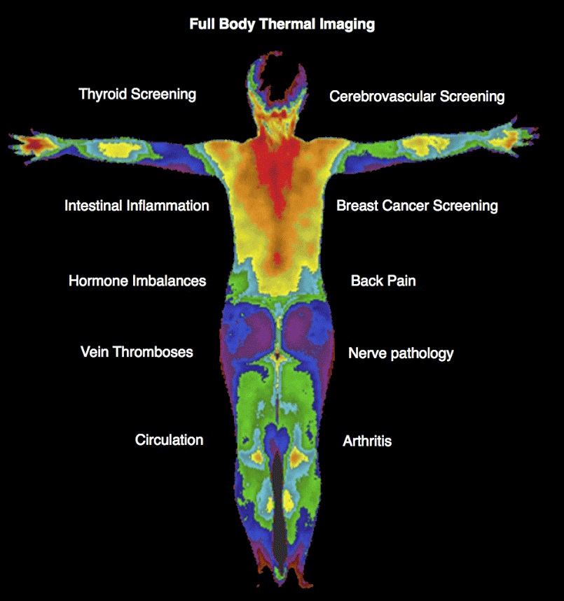 Image of a full body thermogram in the Chicago area. This also includes a breast thermography to help with early breast cancer detection. There are more benefits to thermography in Orland Park, IL than cancer detection. Call today to learn more.