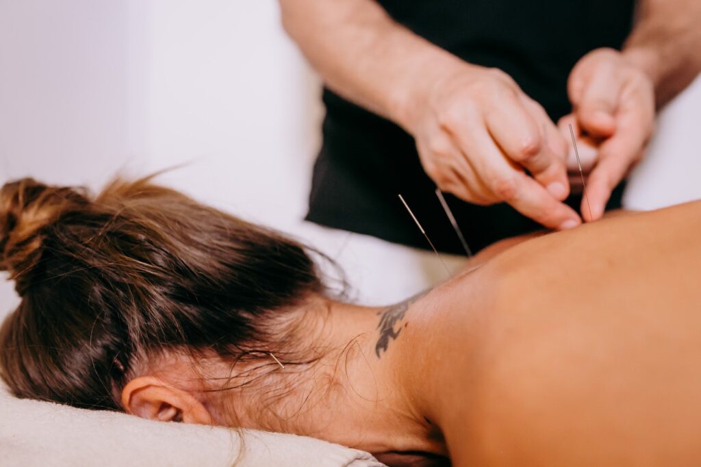 A close up of a person receiving acupuncture in the back. Learn how a functional medicine doctor in Orland Park, IL can offer support with detoxification in Orland Park, IL. 
