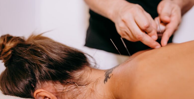 A woman lays face down while getting acupuncture needles in her upper back. Acupuncture in Orland Park, IL can offer support with other medical concerns including chronic pain. Contact an acupuncturist in Orland Park, IL to learn more about the help that holistic medicine in the chicago area can offer.