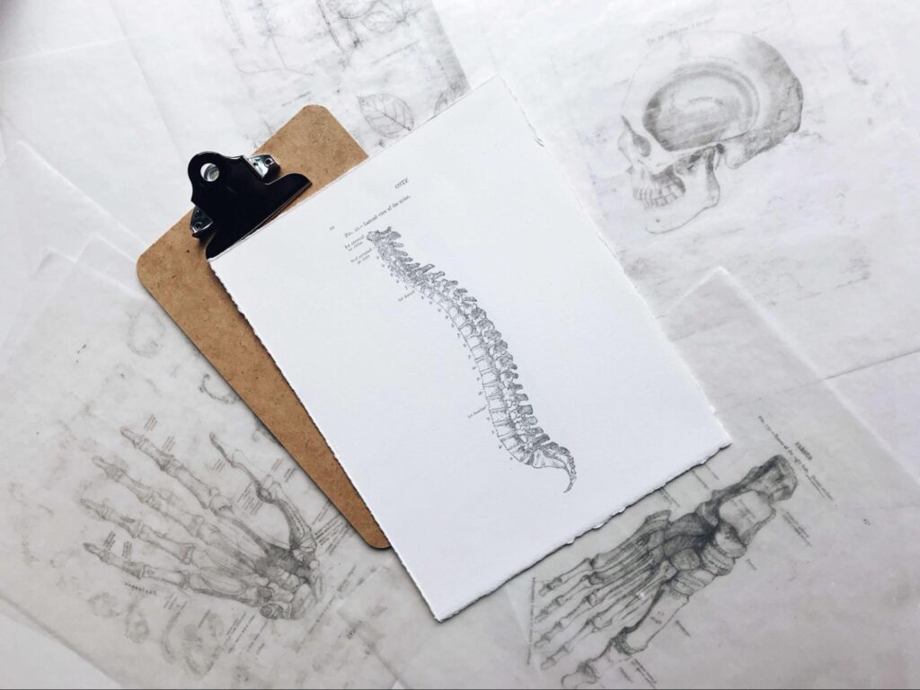 An image of a spine on a clipboard. This could represent the importance of chiropractic care for sciatica in Orland Park, IL. Search for chiropractic care in Orland Park, IL or for acupuncture in Orland Park, IL for support. 
