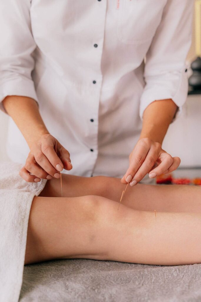 A person places needles above and below a persons knee. Learn more about acupuncture in Orland Park, IL and how an acupuncturist in the Chicago area can offer support. Search for holistic medicine in the chicago area to learn more.
