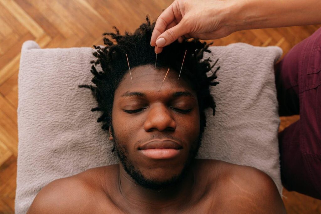 A man lays on an acupuncture table with eyes closed has a person places needles on their forehead. Acupuncture in Orland Park, IL can offer support with overcoming pain, stress, and other metal health concerns. An acupuncturist in Orland Park, IL can tell you more how holistic acupuncture Orland Park, IL can support you.
