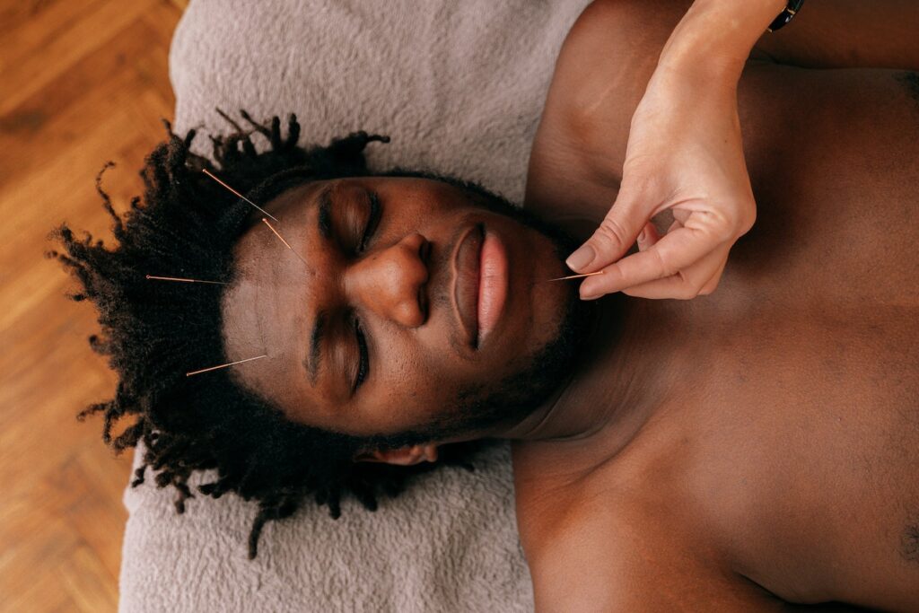 A close up of a black man laying on their back with acupuncture needles in his face. Learn more about how a holistic doctor in Orland Park, IL can offer support. Contact a holistic chiropractor in the Chicago Area to learn more about acupuncture in Orland Park, IL and other serivces. 
