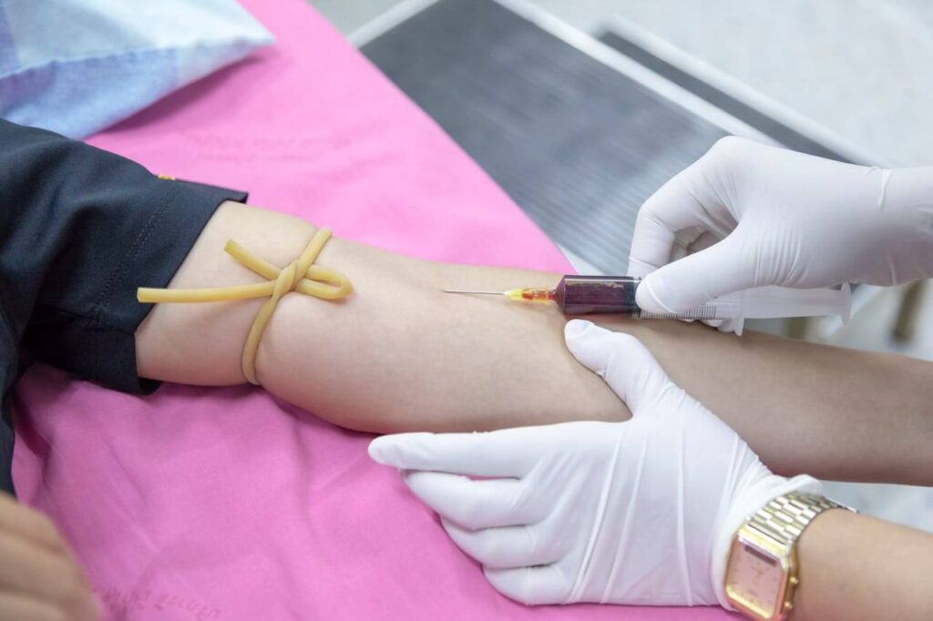 A healthcare professional wearing gloves draws blood from a patient's arm using a syringe. This could represent the process of hormone testing in Orland Park, IL. Search for functional medicine in Orland Park, IL and learn more about the support that functional medicine can offer. Contact a functional medicine doctor in the Chicago area today.
