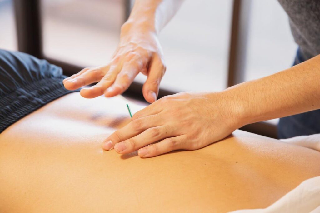 Shows an acupuncturist in the chicago area inserting a needle into the client's stomach. Represents how a functional medicine doctor in the chicago area can also provide acupuncture.